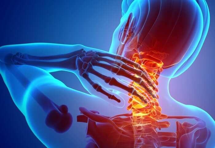 Disc Replacement Surgery Recovery Protocols