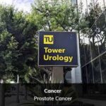 Navigating Prostate Cancer: The Power of a Second Opinion for Informed Choices