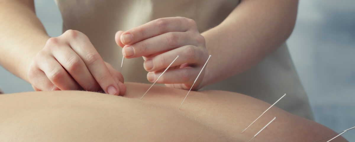The Role of Acupuncture in Sports Injuries