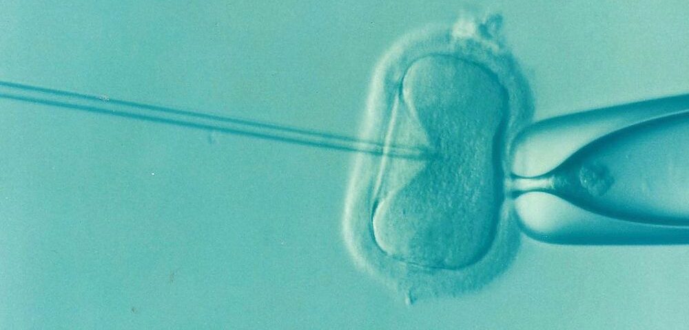 Understanding Infertility Treatment Options for Women Over 35