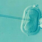 Understanding Infertility Treatment Options for Women Over 35