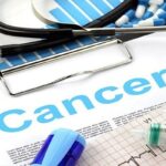 4 Treatment Options After Being Diagnosed With Colon Cancer
