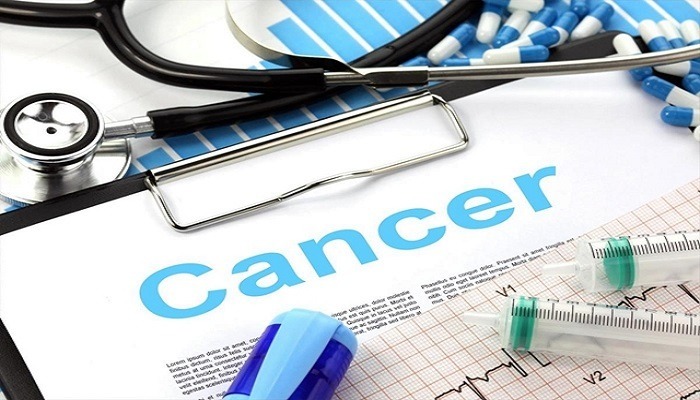 4 Treatment Options After Being Diagnosed With Colon Cancer