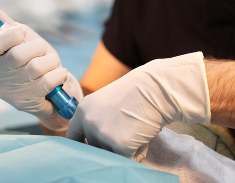 An Overview of Anesthesiology Techniques and Their Uses
