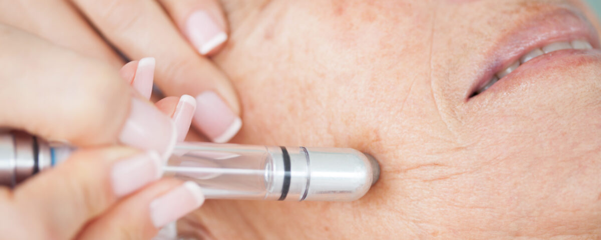 How Dermatologists Monitor Your Skin After Skin Cancer Treatment