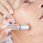 How Dermatologists Monitor Your Skin After Skin Cancer Treatment
