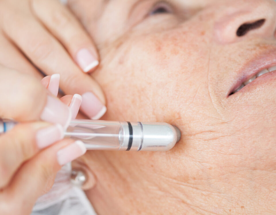 How Dermatologists Monitor Your Skin After Skin Cancer Treatment