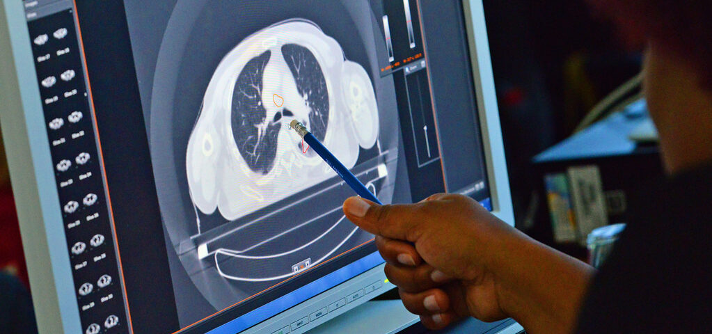 Myths and Facts About CT Scans and Radiation Exposure