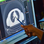 Myths and Facts About CT Scans and Radiation Exposure