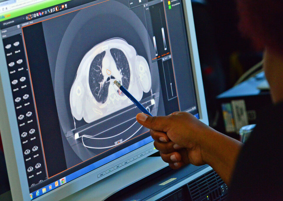 Myths and Facts About CT Scans and Radiation Exposure