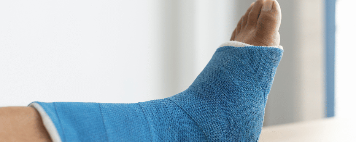 Navigating Recovery After an Ankle Fracture