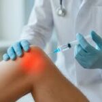 PRP Injections for Knee Osteoarthritis: What Patients Need to Know