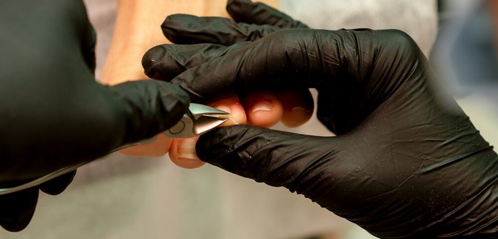 Prevention and Care Tips for Ingrown Toenails