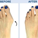 The Connection Between Podiatry and Foot Surgery Recovery