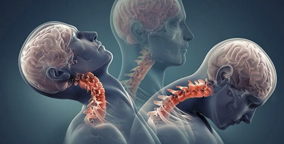 The Importance Of Early Intervention In Neck Injury Cases