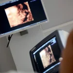 The Significance of Ultrasound in Obstetric Care
