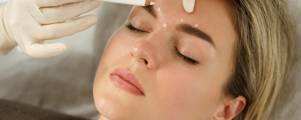 Using Botox for Migraine Management