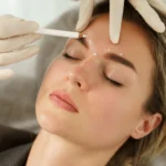 Using Botox for Migraine Management