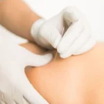 What Patients Should Ask Their Orthopedic Spine Surgeon