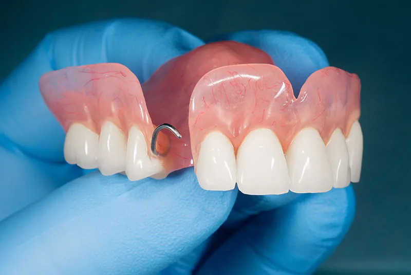 The Different Types of Dentures and Which is Right for you