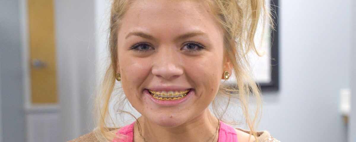 The Intersection of Orthodontics and Jaw Alignment