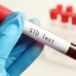 Benefits of Regular STD Testing