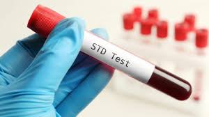 Benefits of Regular STD Testing