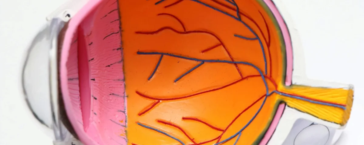 Common Misconceptions About Glaucoma