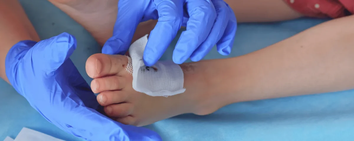 Frequently Asked Questions About Wound Care