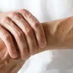 Managing Arthritis With Palliative Care Approaches