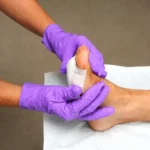 Preventing Complications in Diabetic Foot Care