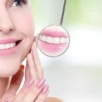 The Role of Cosmetic Dentistry in Restoring Damaged Teeth