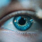 Understanding Cataract Surgery