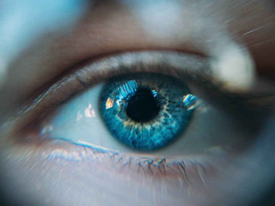 Understanding Cataract Surgery