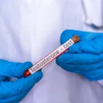 What To Know About Testosterone Replacement Therapy