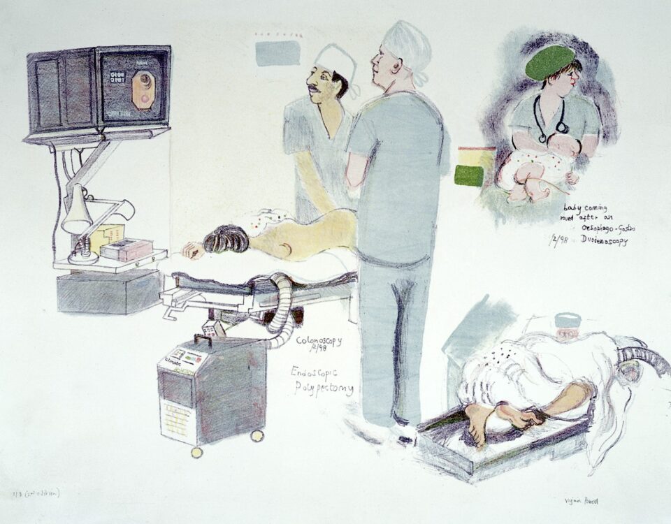 What are the Differences and Uses of Endoscopy and Colonoscopy