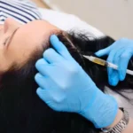 Non-surgical Methods of Hair Restoration