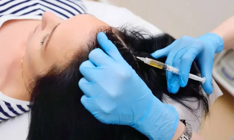 Non-surgical Methods of Hair Restoration