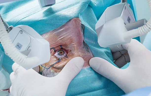 The Latest Advances in LASIK Surgery Technology