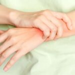 When To Seek Arthritis Treatments