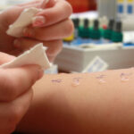 Navigating the Allergy Testing Process