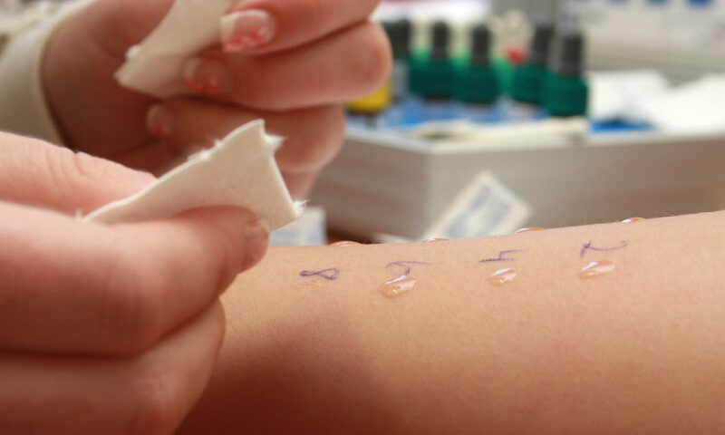 Navigating the Allergy Testing Process