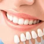 The Power of a Cosmetic Dentist in Smile Makeovers