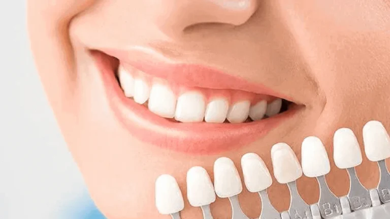 The Power of a Cosmetic Dentist in Smile Makeovers