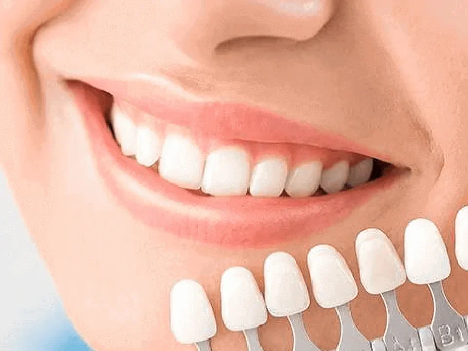 The Power of a Cosmetic Dentist in Smile Makeovers