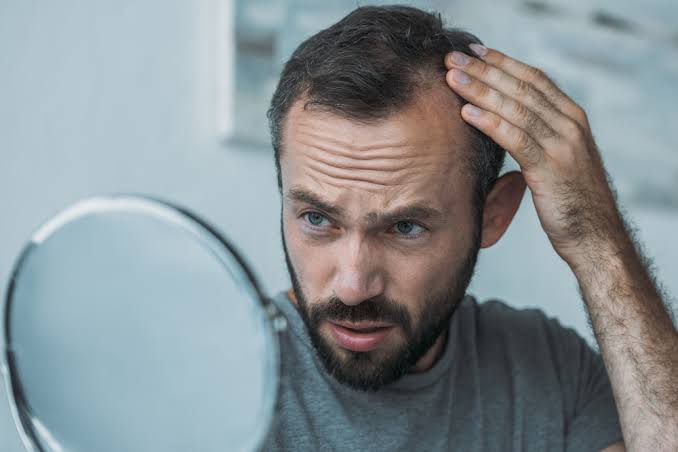 The Role of PRP in Combating Hair Loss