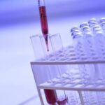 What You Need To Know About Prostate Cancer Screening
