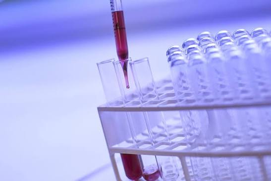 What You Need To Know About Prostate Cancer Screening