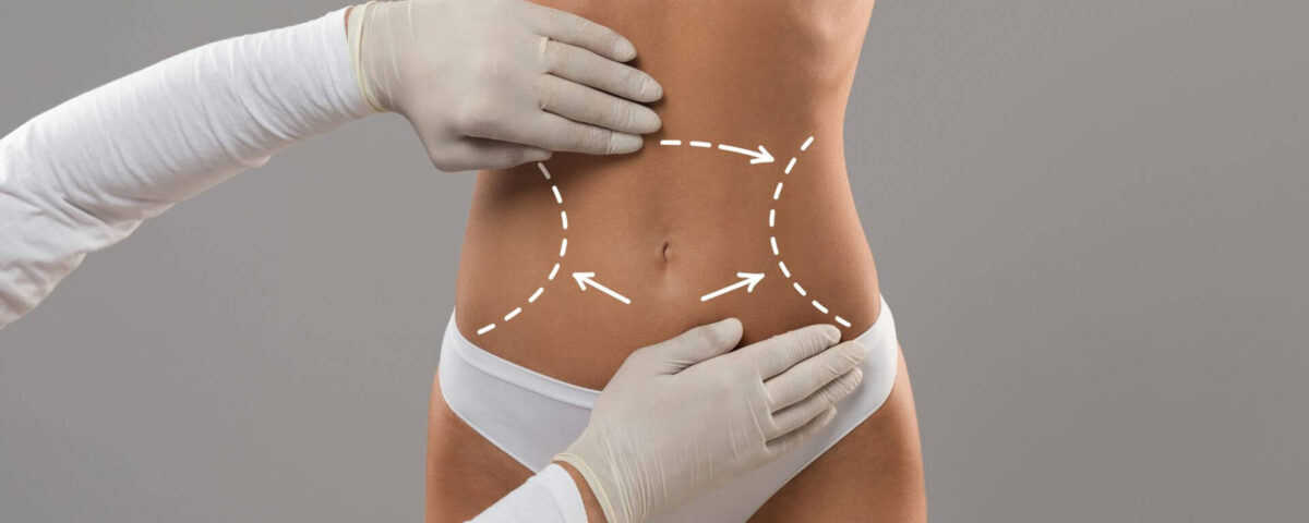 Body Contouring for Every Body Type