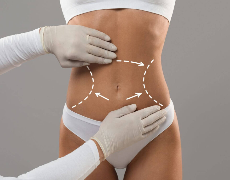 Body Contouring for Every Body Type